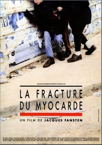 fracture